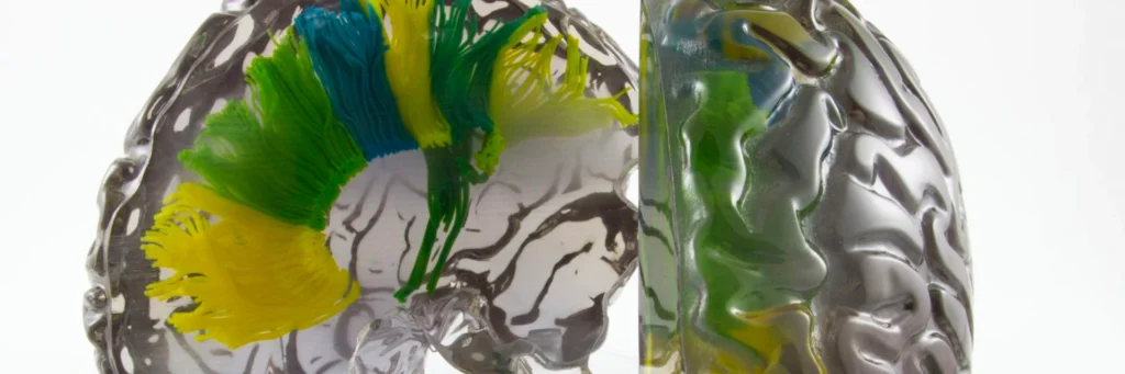 چاپ سه بعدی-dmls 3d printer